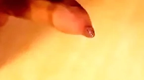 Phimosis cock marvellous cumshot